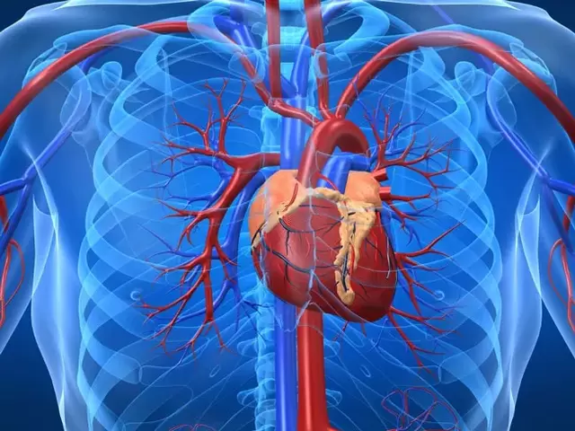 Latihan yang meningkatkan potensi adalah kontraindikasi dalam kes penyakit jantung