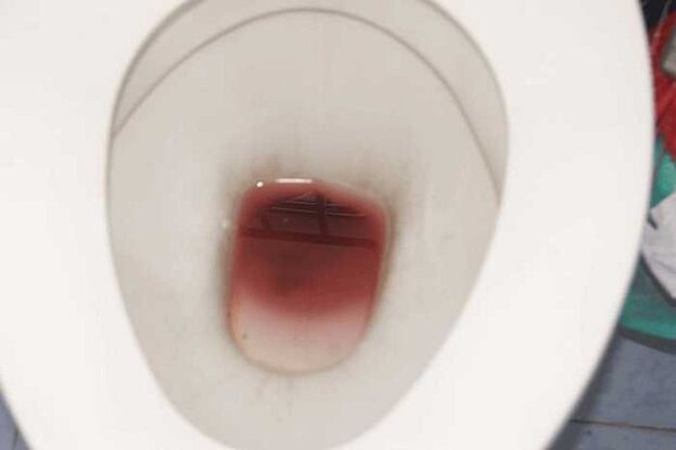 Bercak pada lelaki apabila mereka terangsang